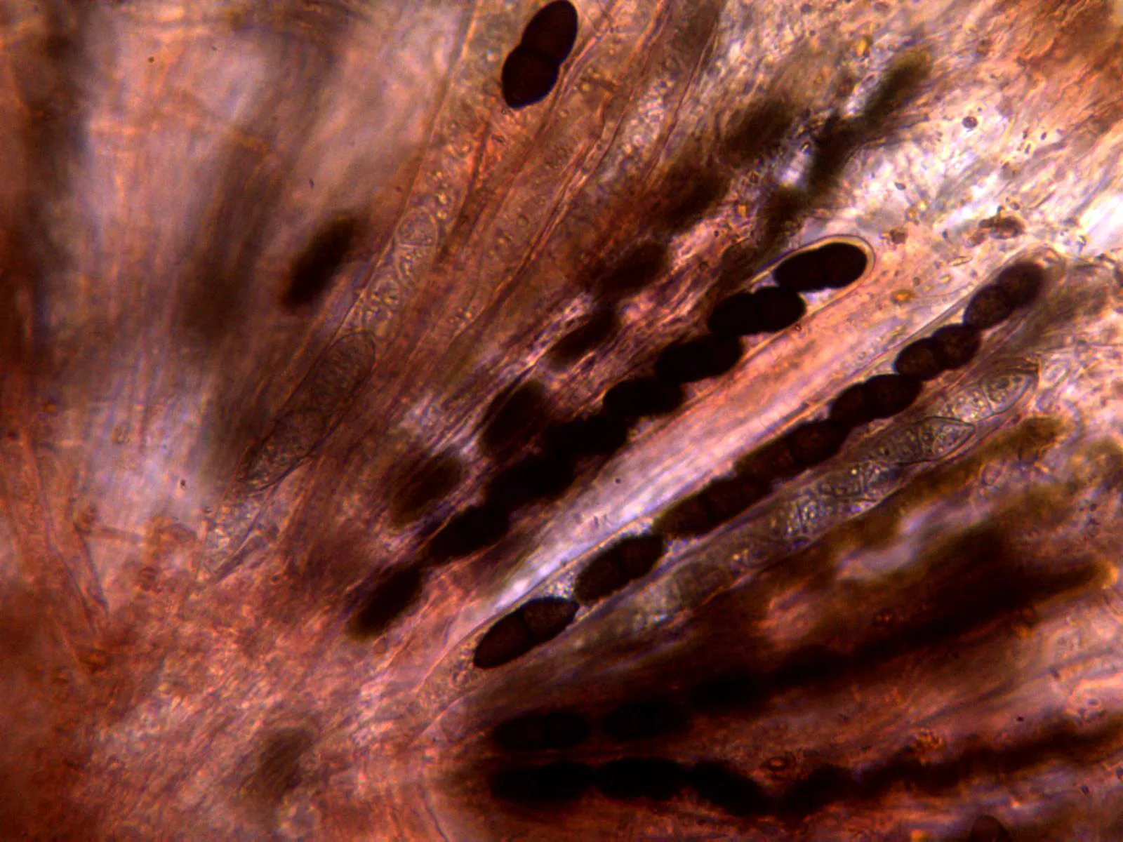 Microscopía de Rhytidhysteron hysterinum - 10 - Ascas x 400